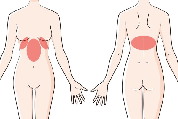 胃痛の図